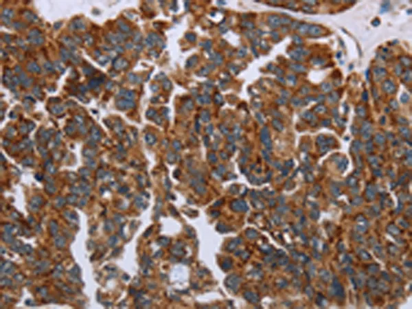 HSD3B2 Rabbit Polyclonal Antibody - image 1