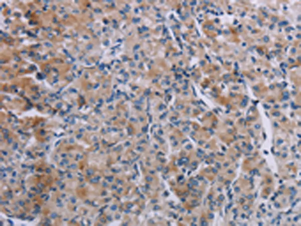 KDM4D Rabbit Polyclonal Antibody - image 1