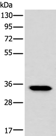 Lactate Dehydrogenase C (LDHC) Rabbit Polyclonal Antibody - image 1