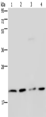 Malignant T cell amplified sequence 1 (MCTS1) Rabbit Polyclonal Antibody - image 1