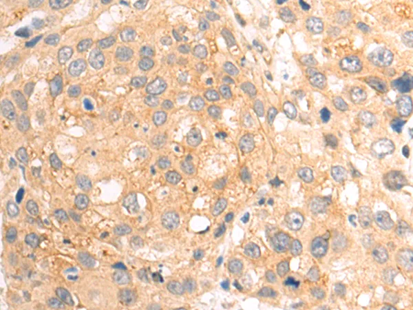 MTF1 Rabbit Polyclonal Antibody - image 1