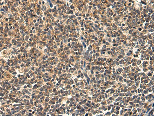 RNF128 Rabbit Polyclonal Antibody - image 1