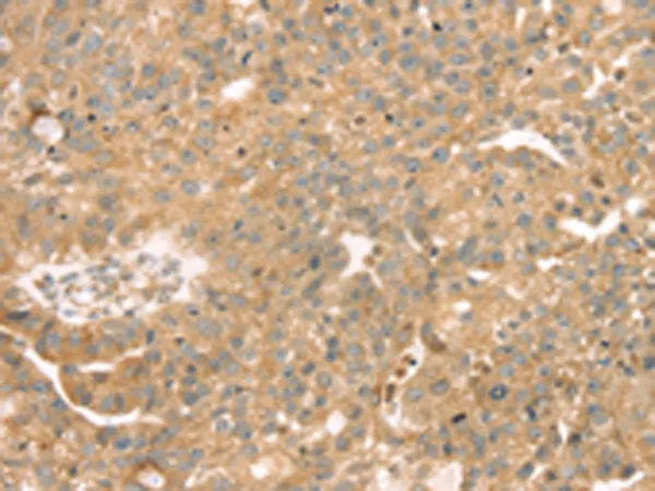 SAMD3 Rabbit Polyclonal Antibody - image 1