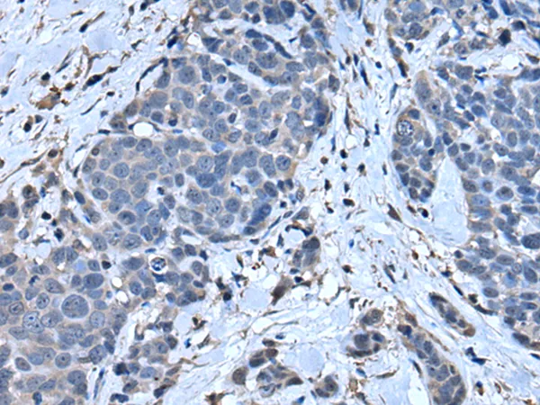 SLPI Rabbit Polyclonal Antibody - image 1