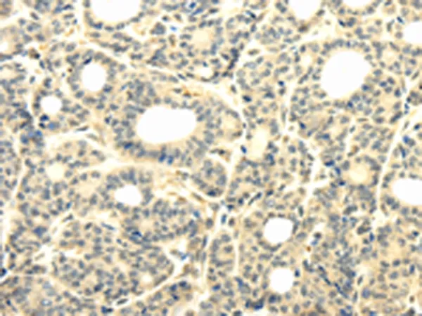 TBC1D22A Rabbit Polyclonal Antibody - image 1