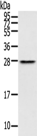 THYN1 Rabbit Polyclonal Antibody - image 1