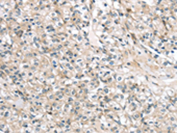 TMPRSS11B Rabbit Polyclonal Antibody - image 1