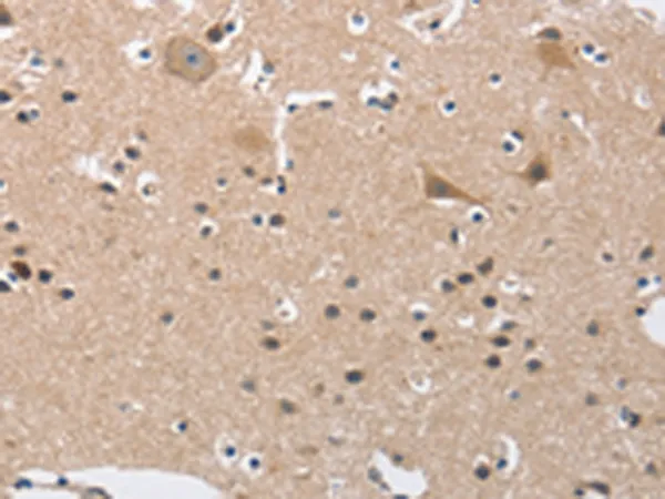 BUB1 Rabbit Polyclonal Antibody - image 1