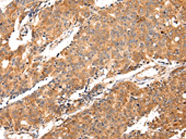 MAP2 Rabbit Polyclonal Antibody - image 1