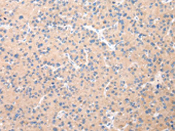 DUSP11 Rabbit Polyclonal Antibody - image 1