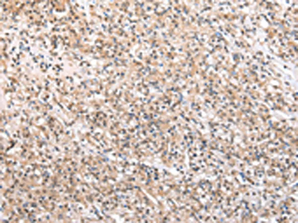 WDR45 Rabbit Polyclonal Antibody - image 1