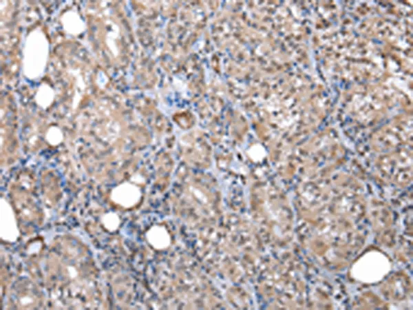 WSB1 Rabbit Polyclonal Antibody - image 1