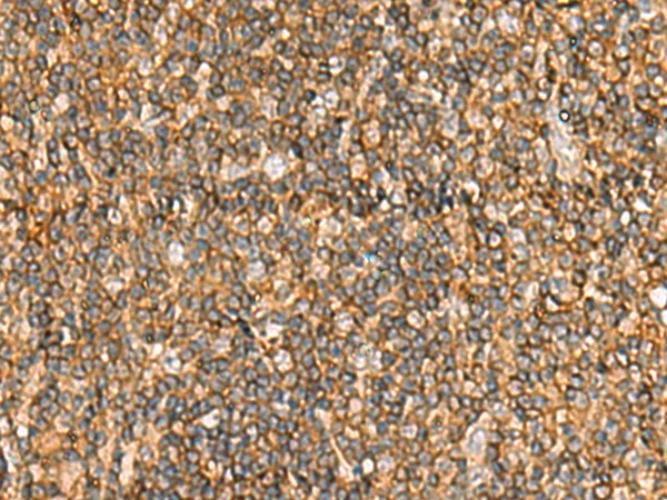 CARD12 (NLRC4) Rabbit Polyclonal Antibody - image 1