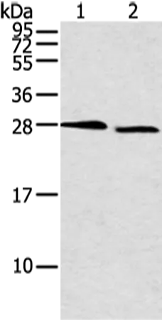 DCXR Rabbit Polyclonal Antibody - image 1