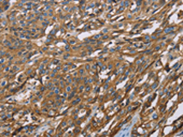 CD147 (BSG) Rabbit Polyclonal Antibody - image 1