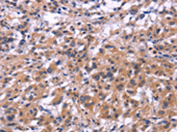 SIGLEC5 Rabbit Polyclonal Antibody - image 1