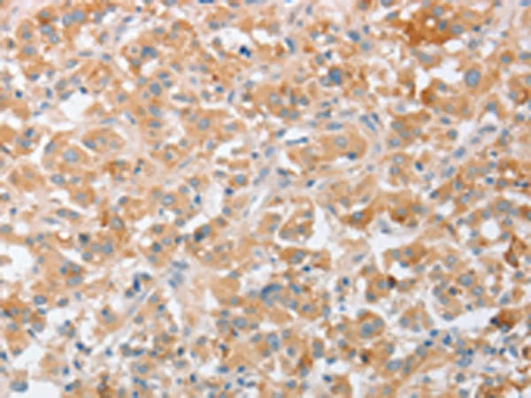 SIGLEC9 Rabbit Polyclonal Antibody - image 1