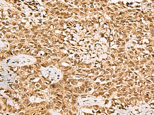 LRRC2 Rabbit Polyclonal Antibody - image 1
