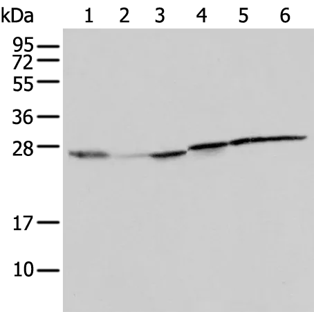 RPL8 Rabbit Polyclonal Antibody - image 1