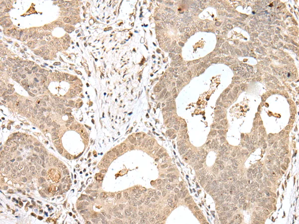 EAP30 (SNF8) Rabbit Polyclonal Antibody - image 1