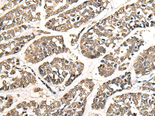 ZNF41 Rabbit Polyclonal Antibody - image 1
