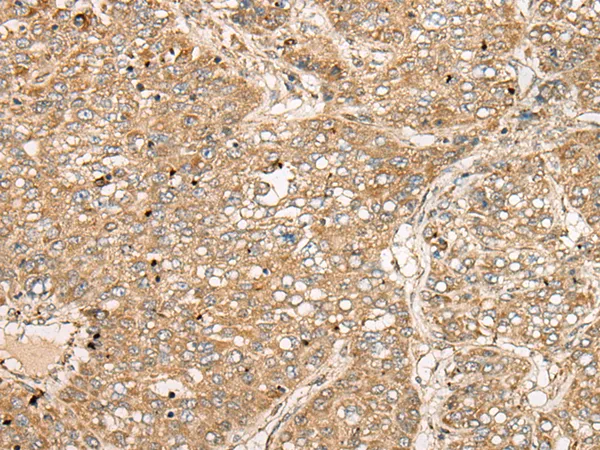 Cripto1 (TDGF1) Rabbit Polyclonal Antibody - image 1
