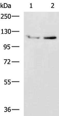 UNC5C Rabbit Polyclonal Antibody - image 1