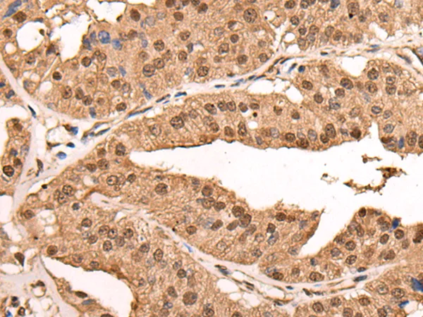 ATRIP Rabbit Polyclonal Antibody - image 1