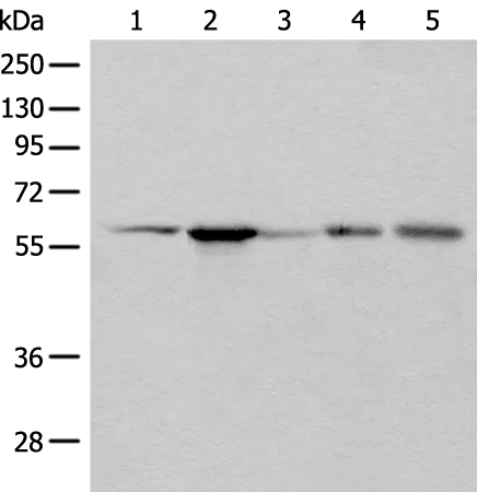 BAIAP2L1 Rabbit Polyclonal Antibody - image 1