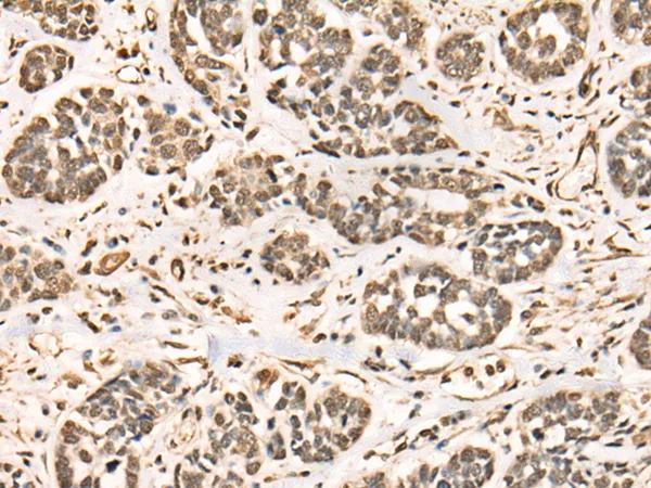 BRD7 Rabbit Polyclonal Antibody - image 1