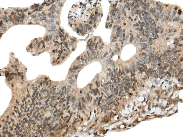 CALML5 Rabbit Polyclonal Antibody - image 1