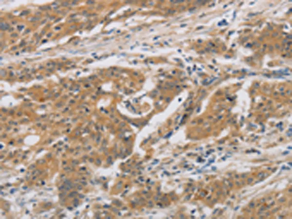 CST6 Rabbit Polyclonal Antibody - image 1