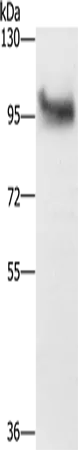 DAB2 Rabbit Polyclonal Antibody - image 1