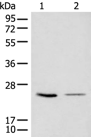 CDCA4 Rabbit Polyclonal Antibody - image 1