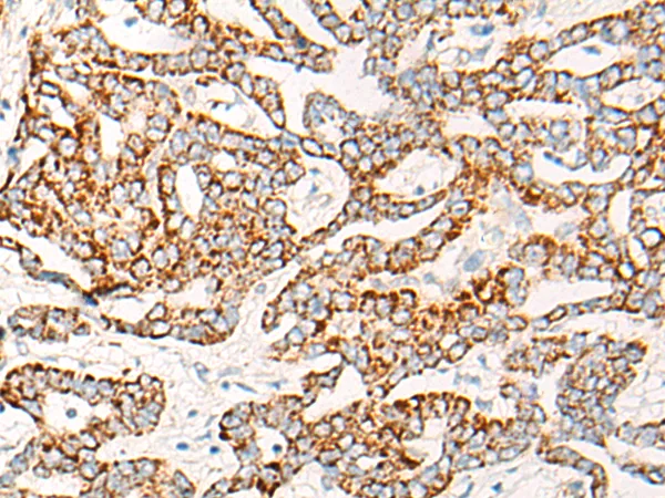 COG2 Rabbit Polyclonal Antibody - image 1