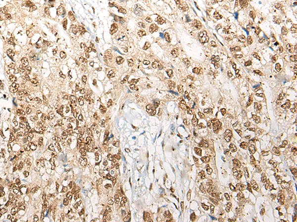 COPS7A Rabbit Polyclonal Antibody - image 1