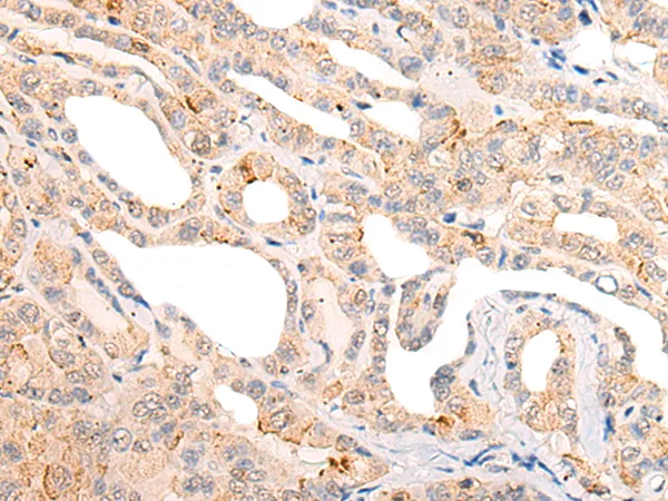 CORO6 Rabbit Polyclonal Antibody - image 1