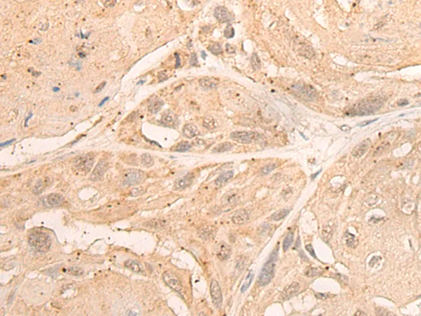 DMC1 Rabbit Polyclonal Antibody - image 1