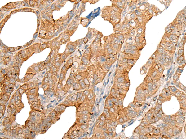 CPT1B Rabbit Polyclonal Antibody - image 1