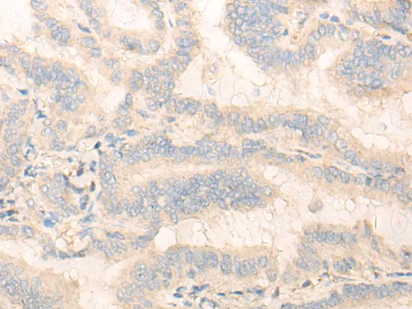 OLFML3 Rabbit Polyclonal Antibody - image 1