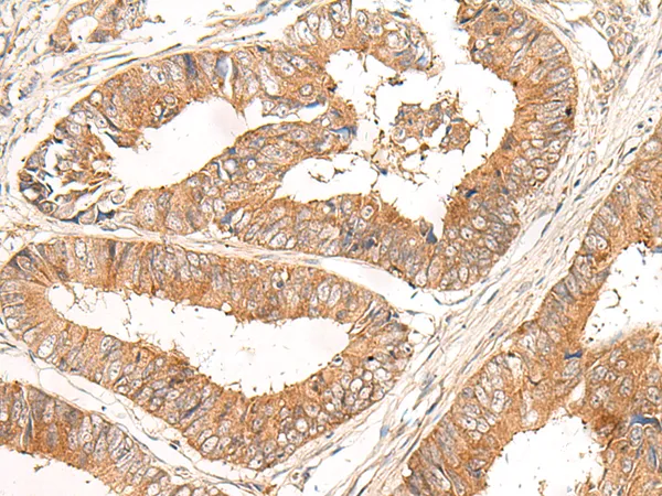 CORO2A Rabbit Polyclonal Antibody - image 1