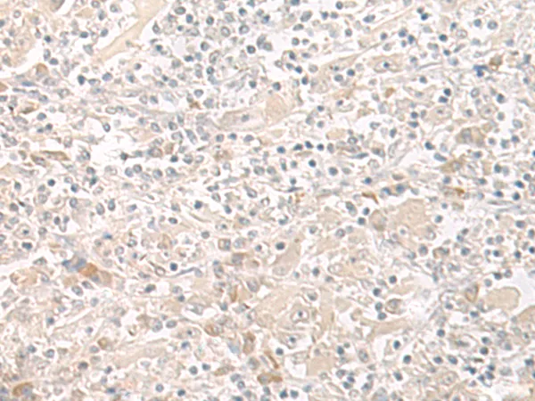 THADA Rabbit Polyclonal Antibody - image 1