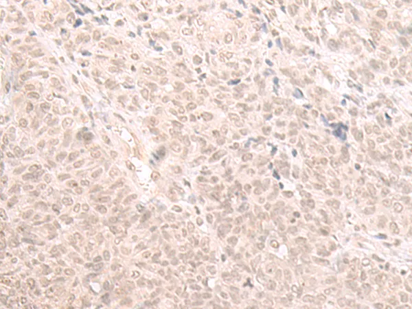 HOOK2 Rabbit Polyclonal Antibody - image 1