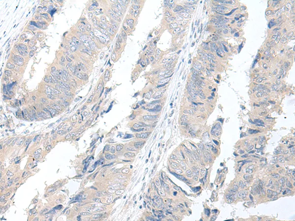 GBA2 Rabbit Polyclonal Antibody - image 1