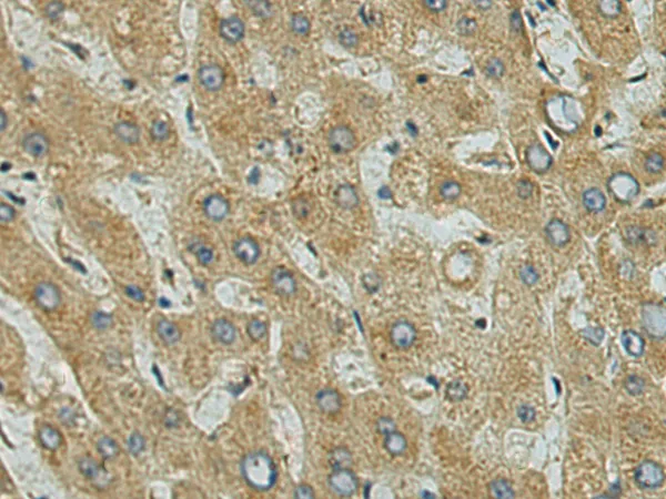 USP53 Rabbit Polyclonal Antibody - image 1