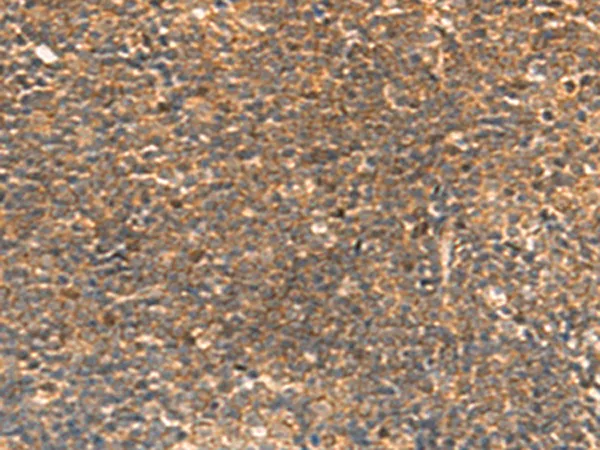 STK32C Rabbit Polyclonal Antibody - image 1