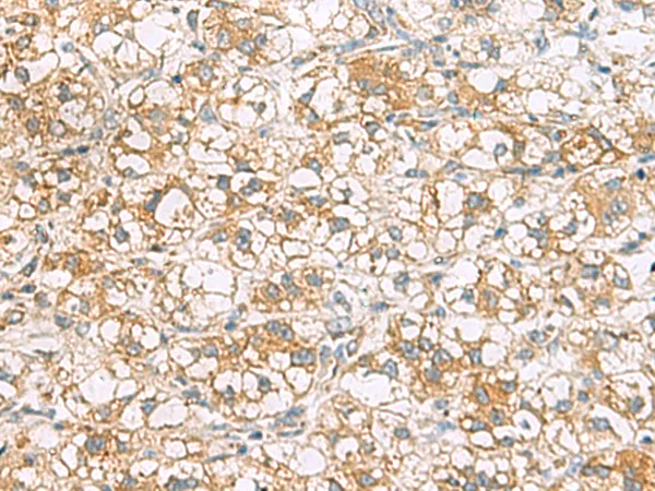 TLE6 Rabbit Polyclonal Antibody - image 1