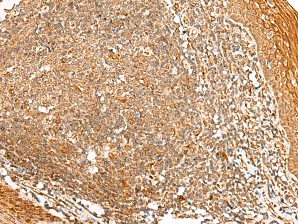 PPOX Rabbit Polyclonal Antibody - image 1