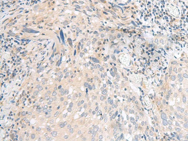 CoCoA (CALCOCO1) Rabbit Polyclonal Antibody - image 1