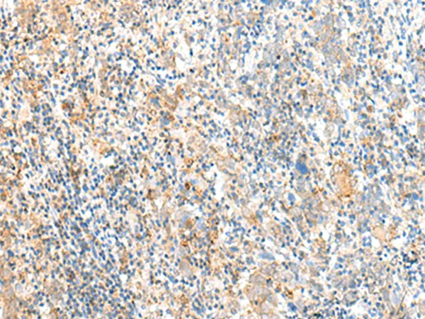 MCFD2 Rabbit Polyclonal Antibody - image 1